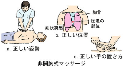 やり方 心臓 マッサージ