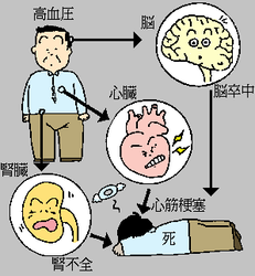 高い 症状 が の 血圧 とき