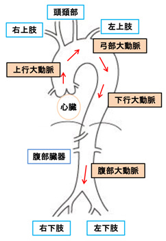 症状 腹部 大動脈 瘤