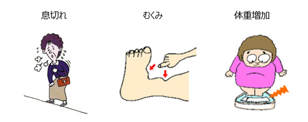 症状 心不全 うっ血 性