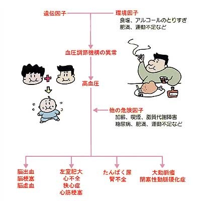 血圧 の 下 が 高い 理由