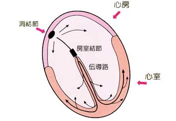 不整脈 治し 方