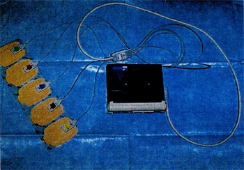 図３：ホルター心電計（携帯型）