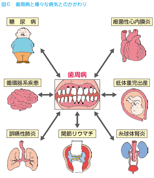 105 歯周病と循環器病 循環器病全般 循環器病あれこれ 国立循環器病研究センター 循環器病情報サービス