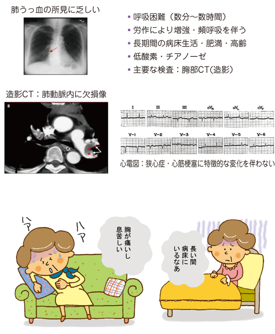 痛い 深呼吸 肺 が 深呼吸をすると胸が痛いんです。