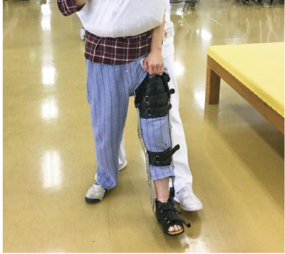 129 脳卒中のリハビリテーション いつから始めるのか 脳 循環器病あれこれ 国立循環器病研究センター 循環器病情報サービス