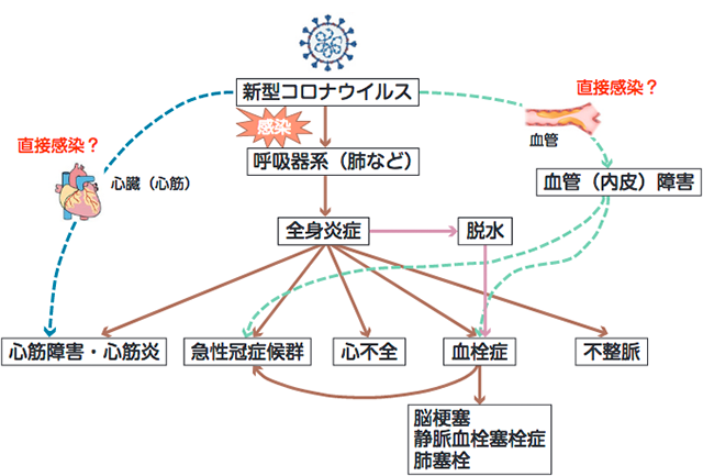 心臓 痛い コロナ