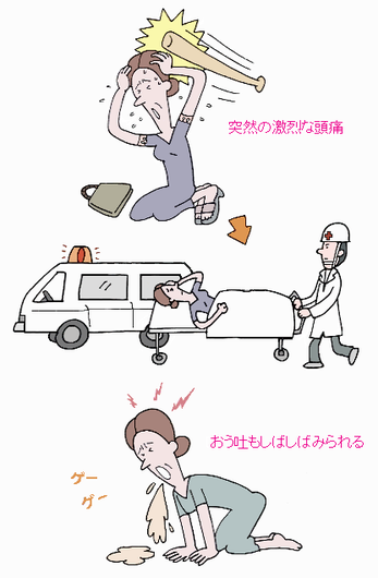 図3:クモ膜下出血の症状