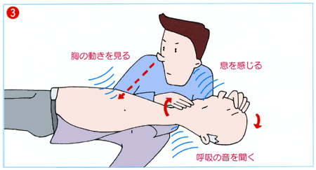 イラスト:(3)気道を確保して呼吸の有無をみます