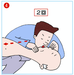 イラスト:(4)口対口人工呼吸を開始します