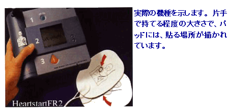 写真:AEDの機種