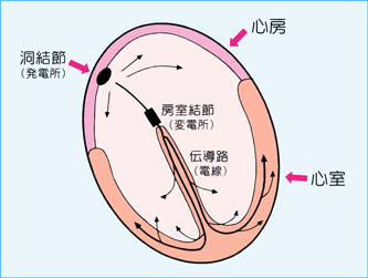 アンツ トルサード ド ポ ＱＴ延長症候群