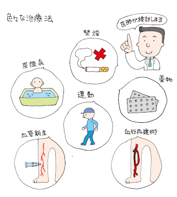 硬化 と は 動脈 [89] 足の血管病