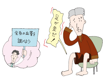 びっこ ひく 医療 用語