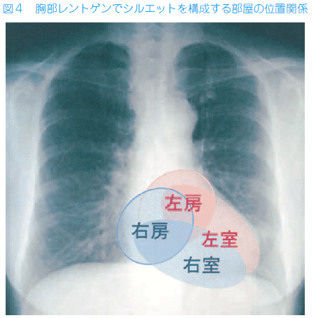 食事 心臓 肥大