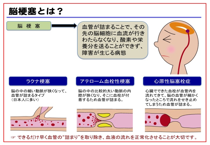 の 病気 種類 脳