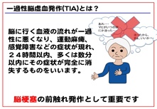 一過性脳虚血発作(TIA)とは?