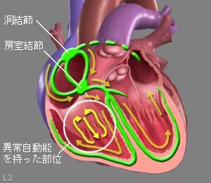 図5 異常自動能
