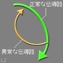 図７ アブレーション治療 1