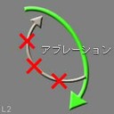 図７ アブレーション治療 3