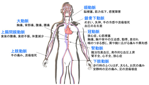 差 血圧 左右