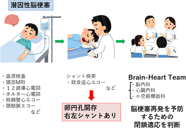 潜因性脳梗塞