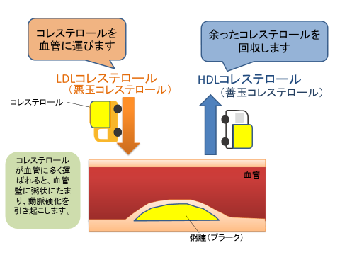 脂質 異常 症 と は