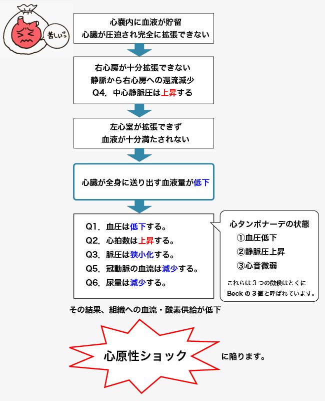 タンポナーデ 心 心タンポナーデ 日本救急医学会・医学用語解説集