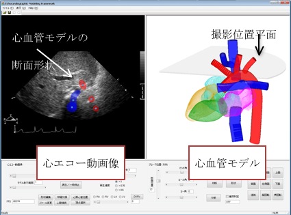 心血管構造の立体ＣＧモデル作成システムを開発