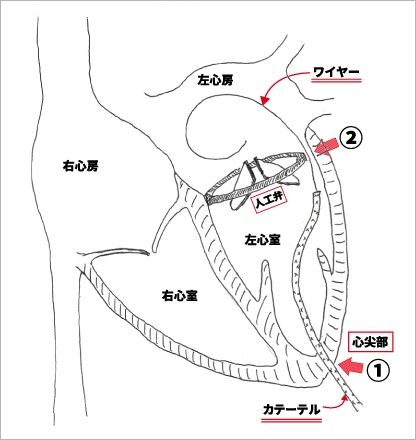 本治療の概要