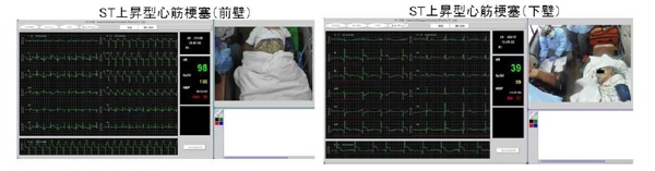 <Figura> Esempio di utilizzo del sistema di telemedicina mobile