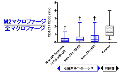 サルコイド肉芽腫を