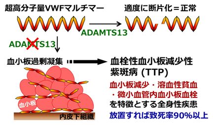 1-1）図：ADAMTS13の欠損による血栓性血小板減少性紫斑病の発症