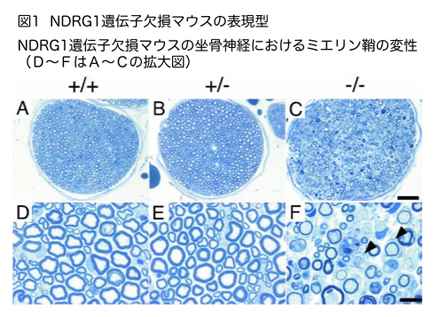 Ndrg1遺伝子欠損マウスの表現型
