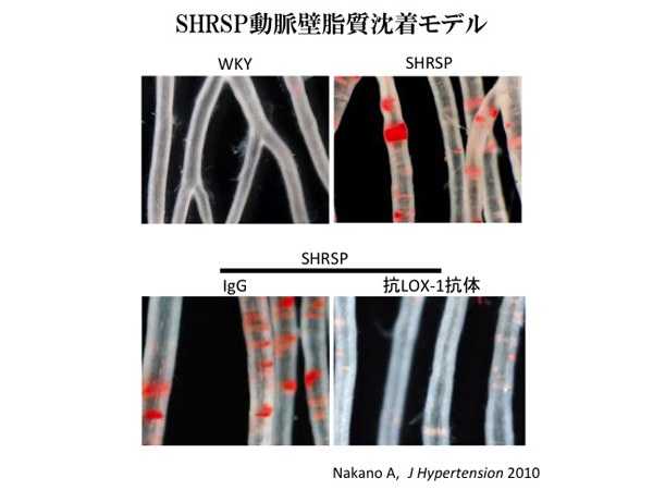 SHRSP動脈壁脂質沈着モデル
