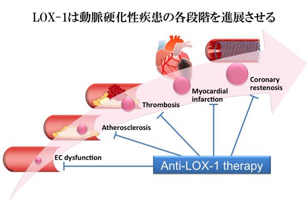 LOX-1は動脈硬化性疾患の各段階を進展させる