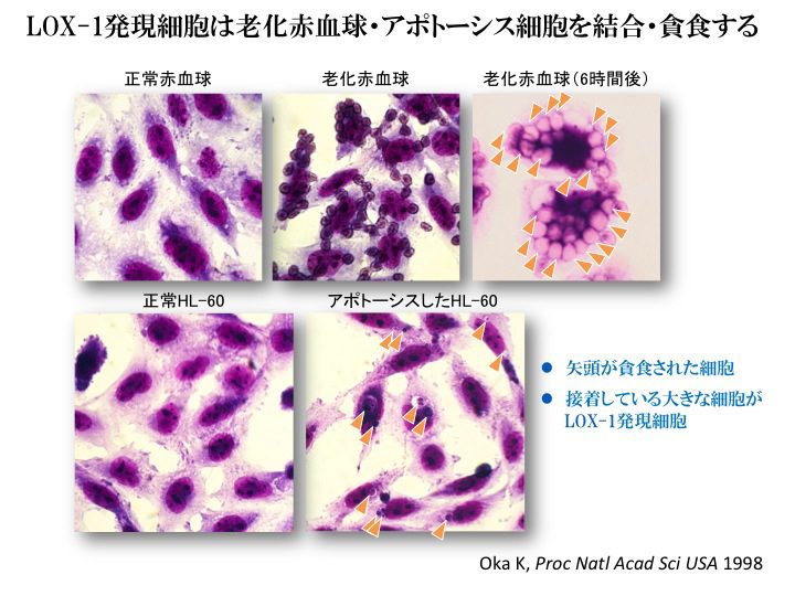 LOX-1発現細胞は老化赤血球・アポトーシス細胞を結合・貪食する 