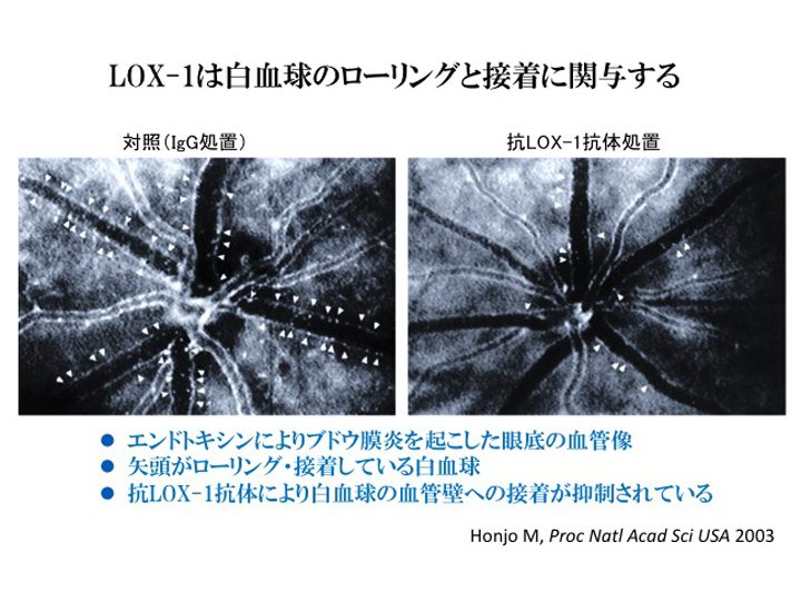 LOX-1は白血球のローリングと接着に関与する 