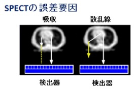 第２図　SPECT画像の誤差要因―吸収と散乱線