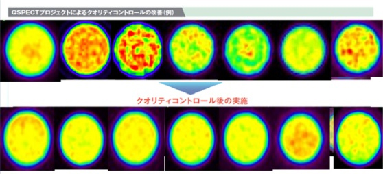 第５図　一様な円筒シリンダファントムに123I-放射性薬剤を封入して撮像した典型的な７施設における画像。QSPECTプログラムを利用することで施設や装置を超えた比較が可能になり、これによりクオリティコントロールの重要さが確認された。定量的な比較指標の必要性が示唆された。