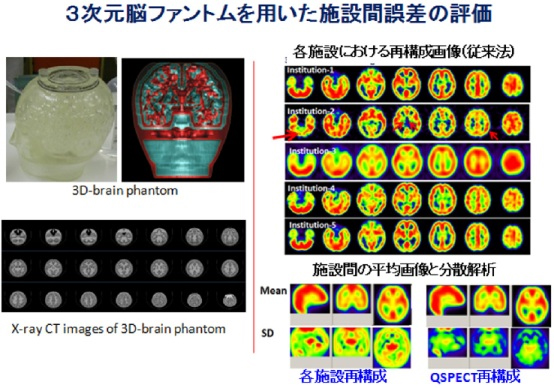 第６図　ヒトの頭蓋を模倣する構造体（ファントム）の開発を行った。ファントムにはには脳灰白質と骨領域が含まれ脳血流量画像の妥当性確認が可能である。典型的な５施設において、各装置に組み込まれた画像再構成では施設間の誤差が相当大であることが認められる。一施設においては偽欠損（赤矢印）を認めるなどの問題も指摘された。施設間の分散はQSPECTプログラムの採用によって大きく改善していた。