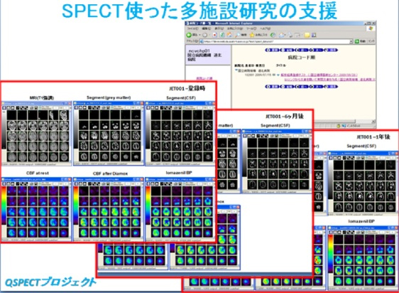 第７図　解析の進捗を登録施設や主任研究者らと情報共有するためのＷｅｂベースの閲覧システム。図は経過観察中のＭＲＩ画像とSPECT機能画像を全て同一座標に重ね合わせた結果の解析進捗を示すもの。