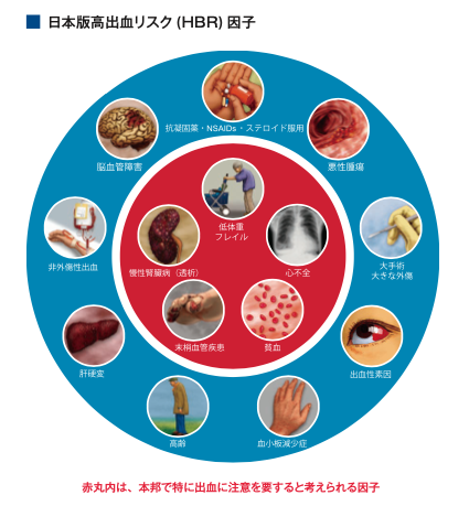 日本版高出血リスク