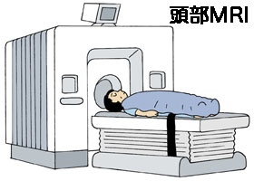 頭部MRI