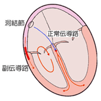 図