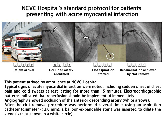 NCVC Hospital's standard protocol for patients presenting with acute myocardial infarction