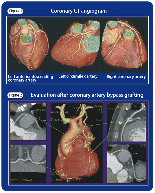 To Medicalstaff｜cardiovascular Department Division Of Coronary