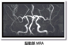 脳動脈MRA