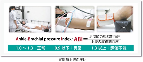 足関節上腕血圧比