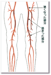 高度循環器ドック